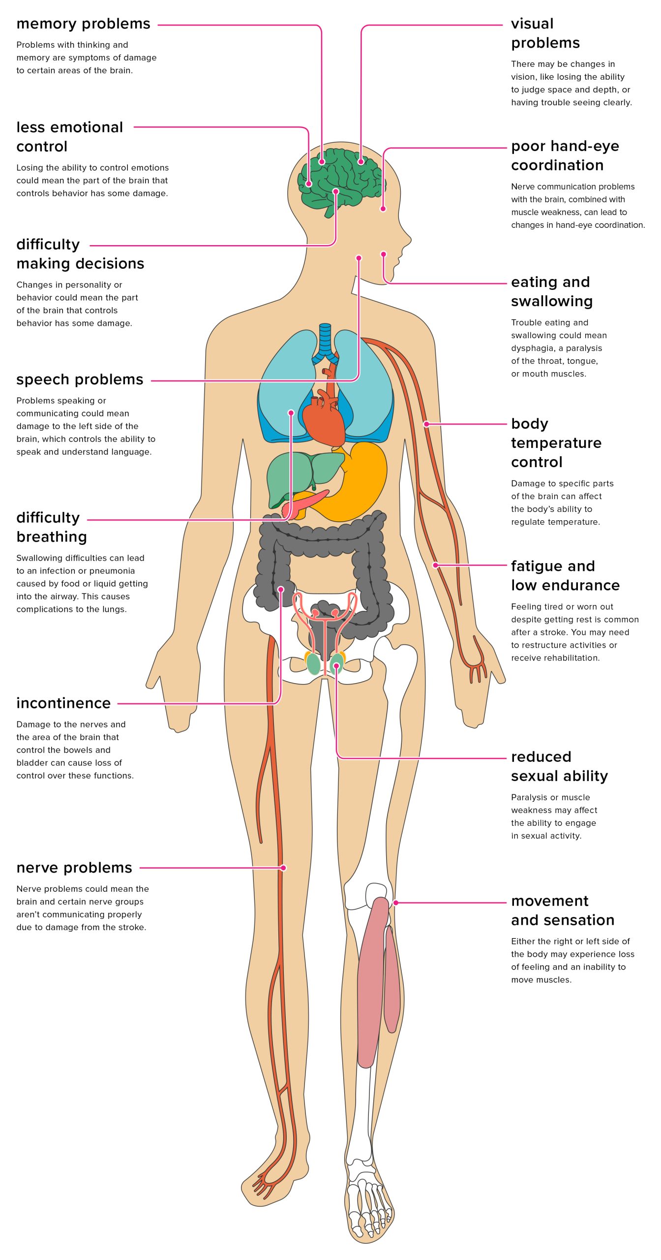 The Effects of Stroke on the Body – Cape Rehab Team | Cape Town